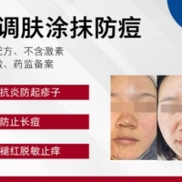 轻调肤涂抹防痘