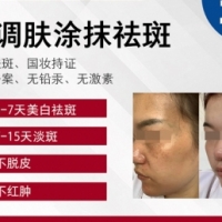 轻调肤涂抹祛斑