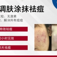 轻调肤涂抹祛痘