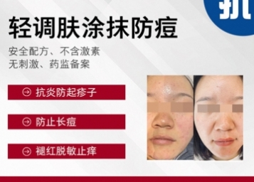 轻调肤涂抹防痘