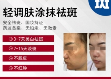 轻调肤涂抹祛斑
